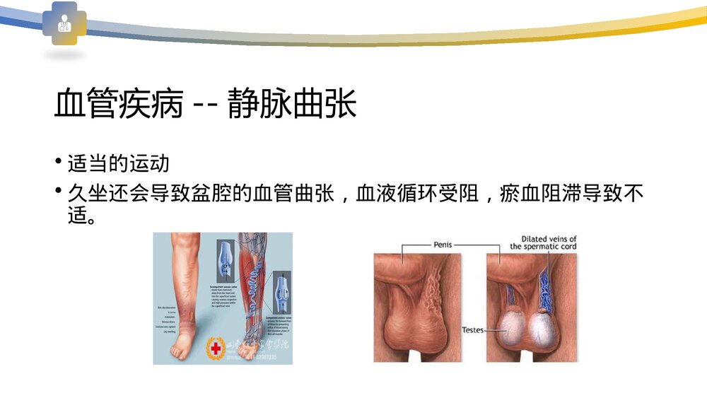 血管病变及防治PPT课件下载10