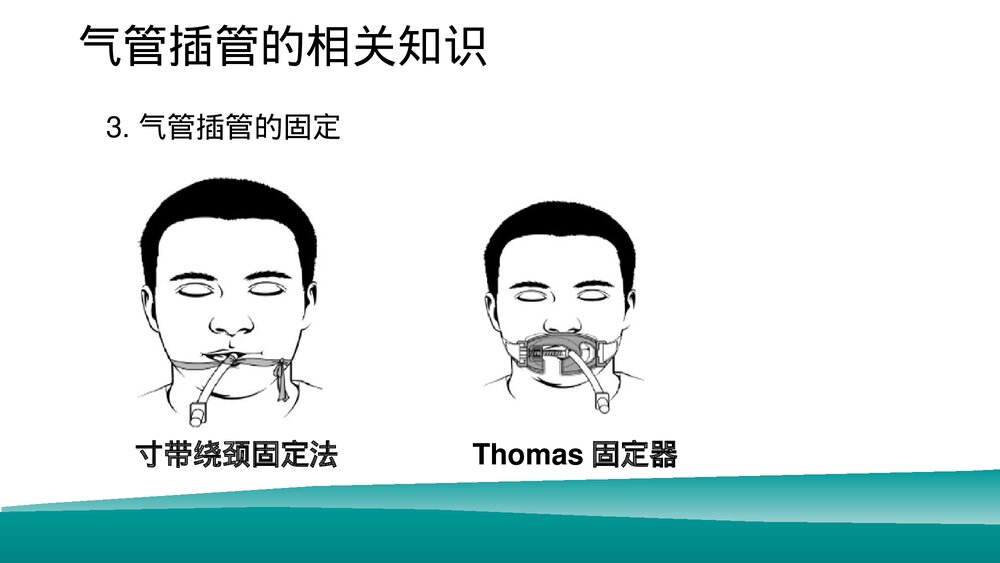 经口气管插管患者的口腔护理PPT课件下载（共16页·可编辑修改）7