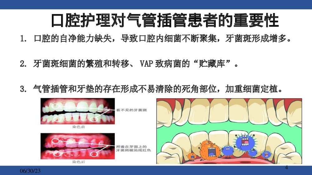气管插管病人的口腔护理PPT课件下载4