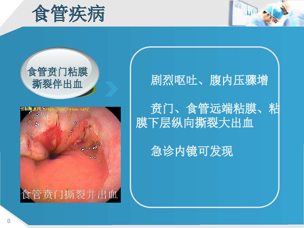 上消化道出血的护理PPT课件下载(共73页·可编辑修改)8