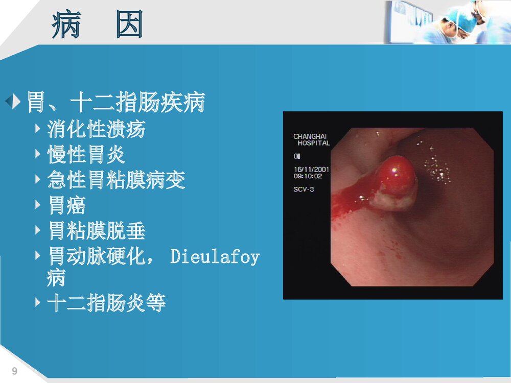 上消化道出血的护理PPT课件下载(共73页·可编辑修改)9