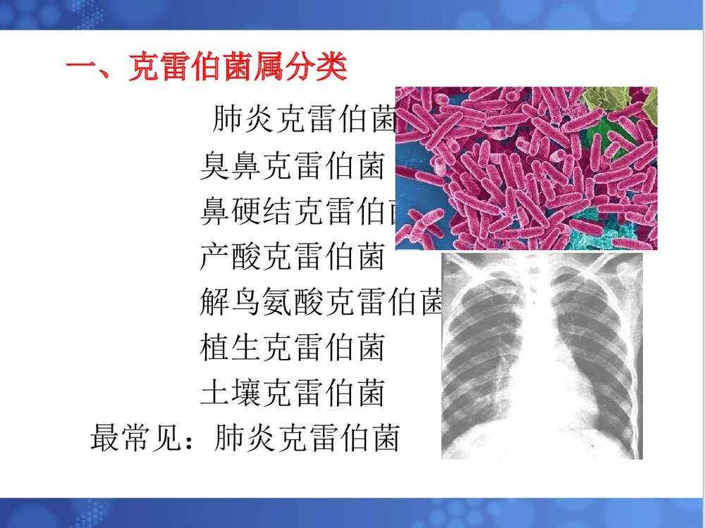 克雷伯菌属PPT课件下载(共33页·可编辑修改)3
