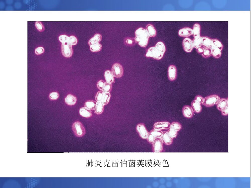 克雷伯菌属PPT课件下载(共33页·可编辑修改)5