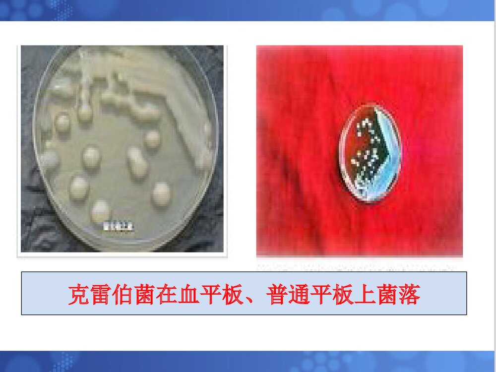 克雷伯菌属PPT课件下载(共33页·可编辑修改)7