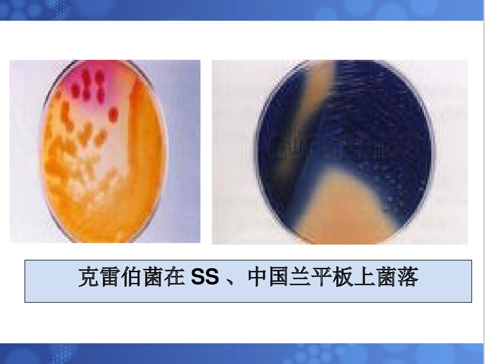 克雷伯菌属PPT课件下载(共33页·可编辑修改)8