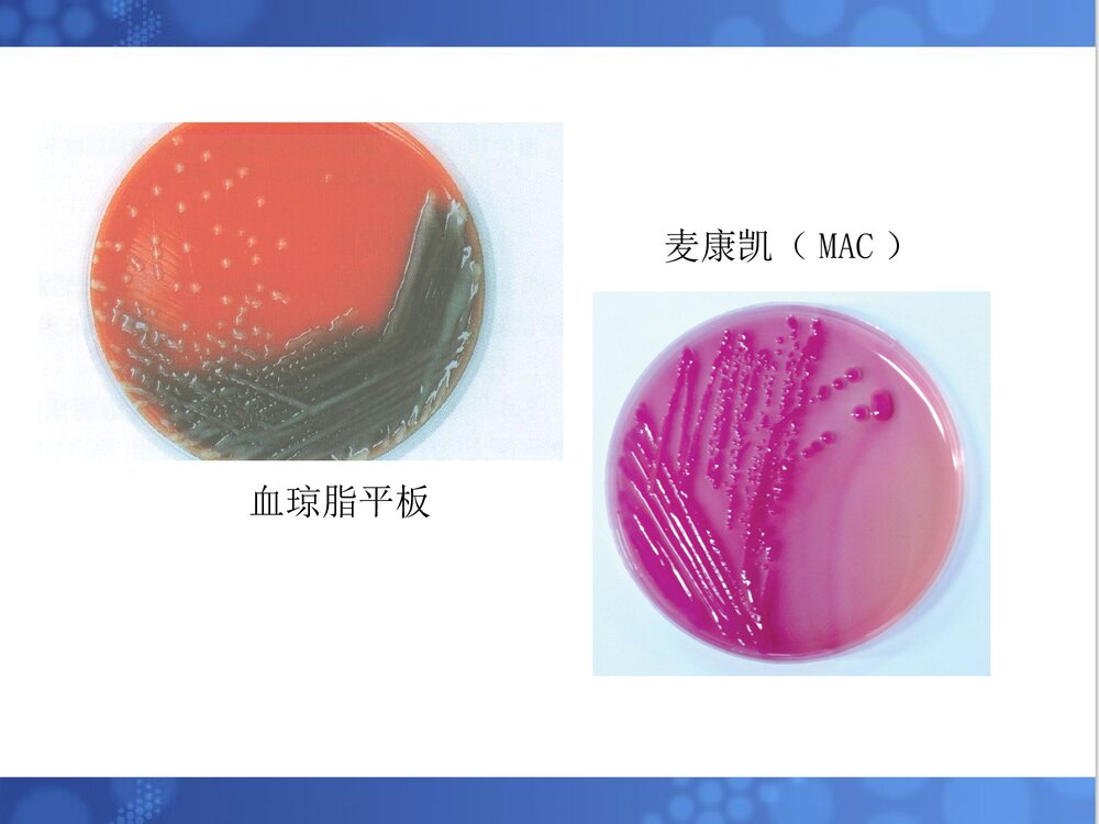 克雷伯菌属PPT课件下载(共33页·可编辑修改)9