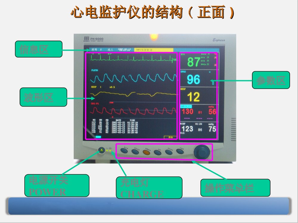 迈瑞监护仪原理和应用PPT课件下载(共68页·可编辑修改)10