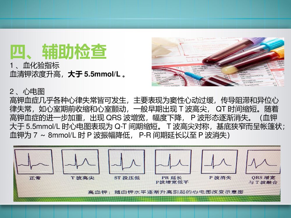 高钾血症患者的护理PPT课件(共11页·可编辑修改)5