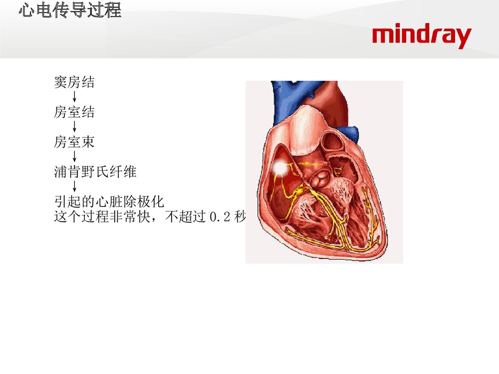 迈瑞监护仪培训ppt课件下载(共66页·电子版可编辑修改)4