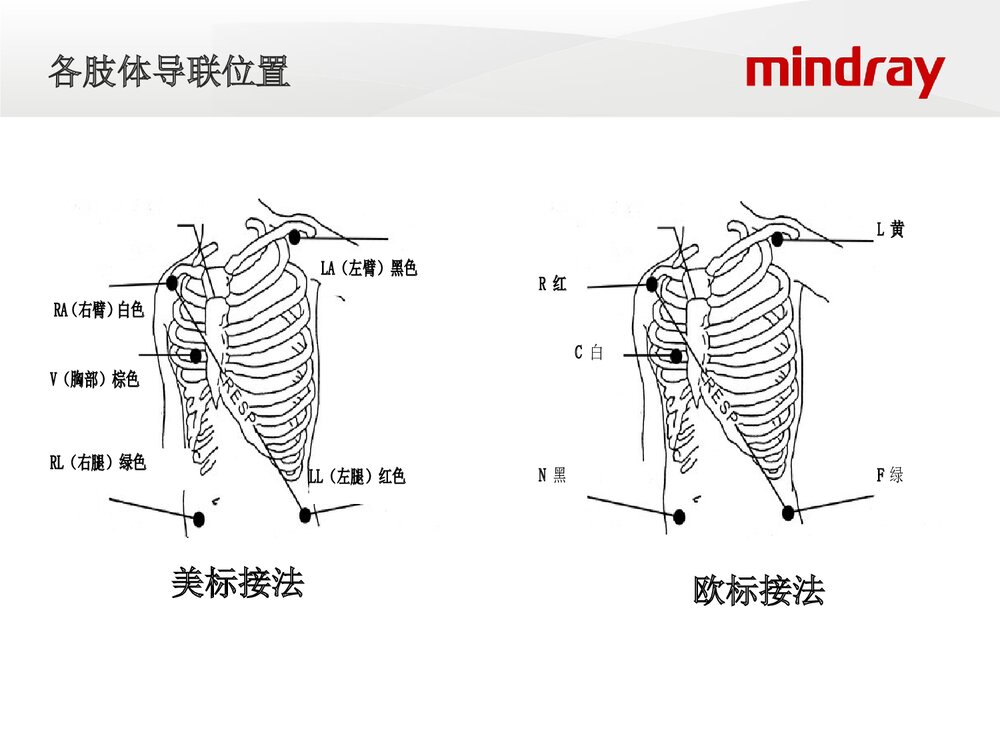 迈瑞监护仪培训ppt课件下载(共66页·电子版可编辑修改)6