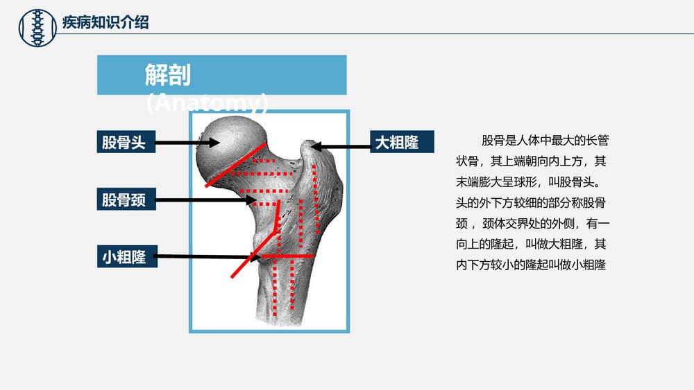 股骨颈骨折护理查房PPT课件下载（共37页·电子版可编辑修改）8