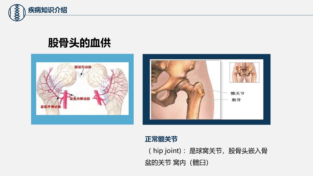 股骨颈骨折护理查房PPT课件下载（共37页·电子版可编辑修改）9