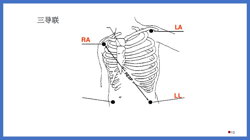 迈瑞监护基础知识PPT课件下载(共58页·可编辑修改)10