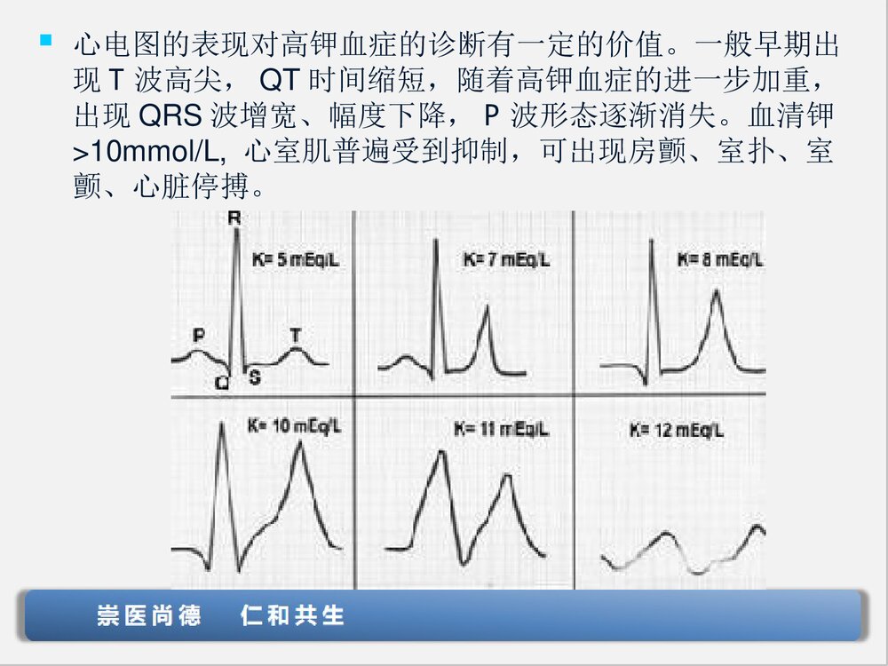 高钾血症的处理PPT课件下载(共19页·可编辑修改)8