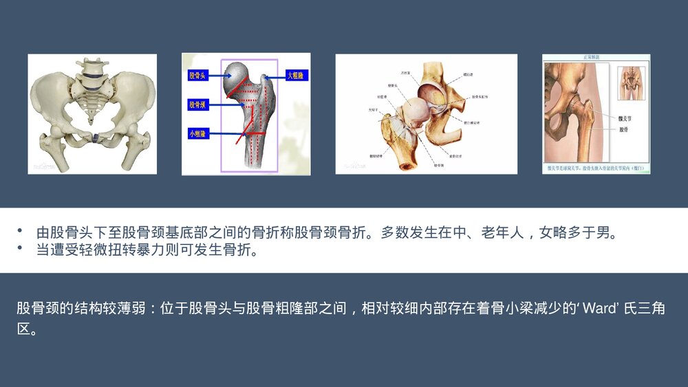 髋关节置换术后护理医学类PPT课件下载(共20页·内容可编辑修改)3