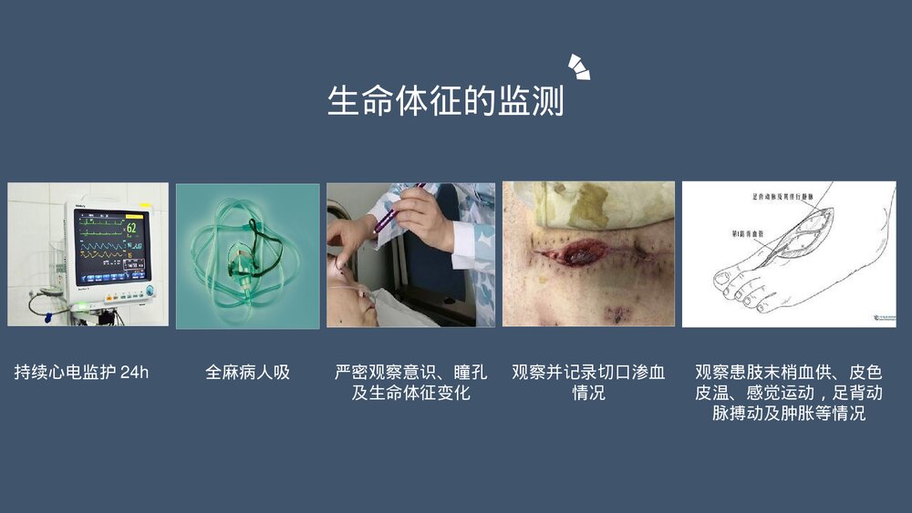 髋关节置换术后护理医学类PPT课件下载(共20页·内容可编辑修改)6