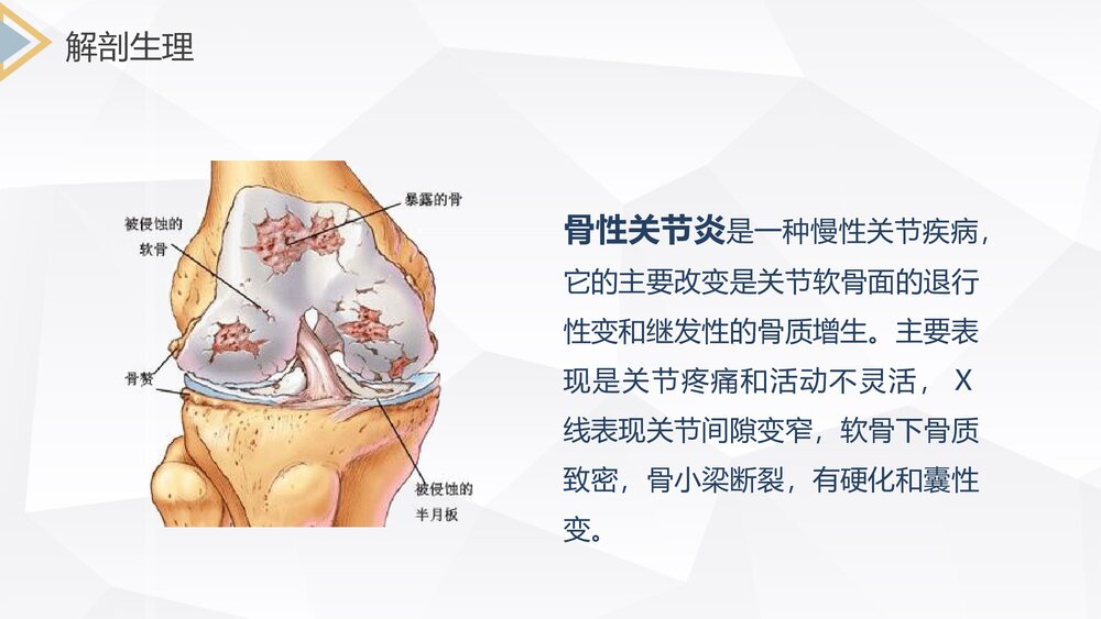 双膝骨性关节炎护理查房PPT课件下载(共26页·内容可编辑修改)4