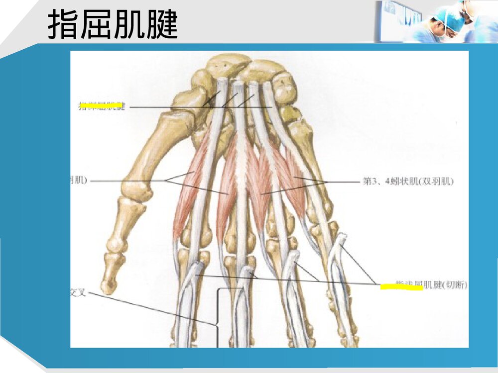 手部肌腱解剖及功能PPT课件下载(共37页·可编辑修改)3
