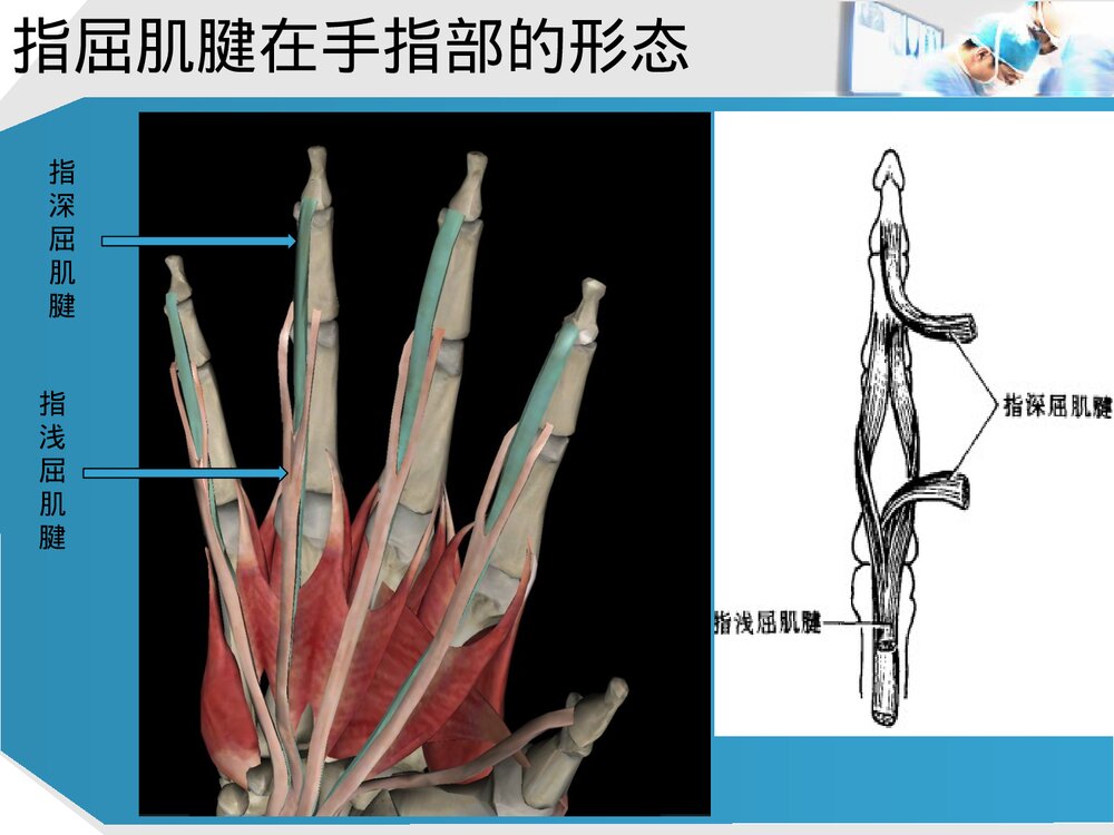 手部肌腱解剖及功能PPT课件下载(共37页·可编辑修改)8