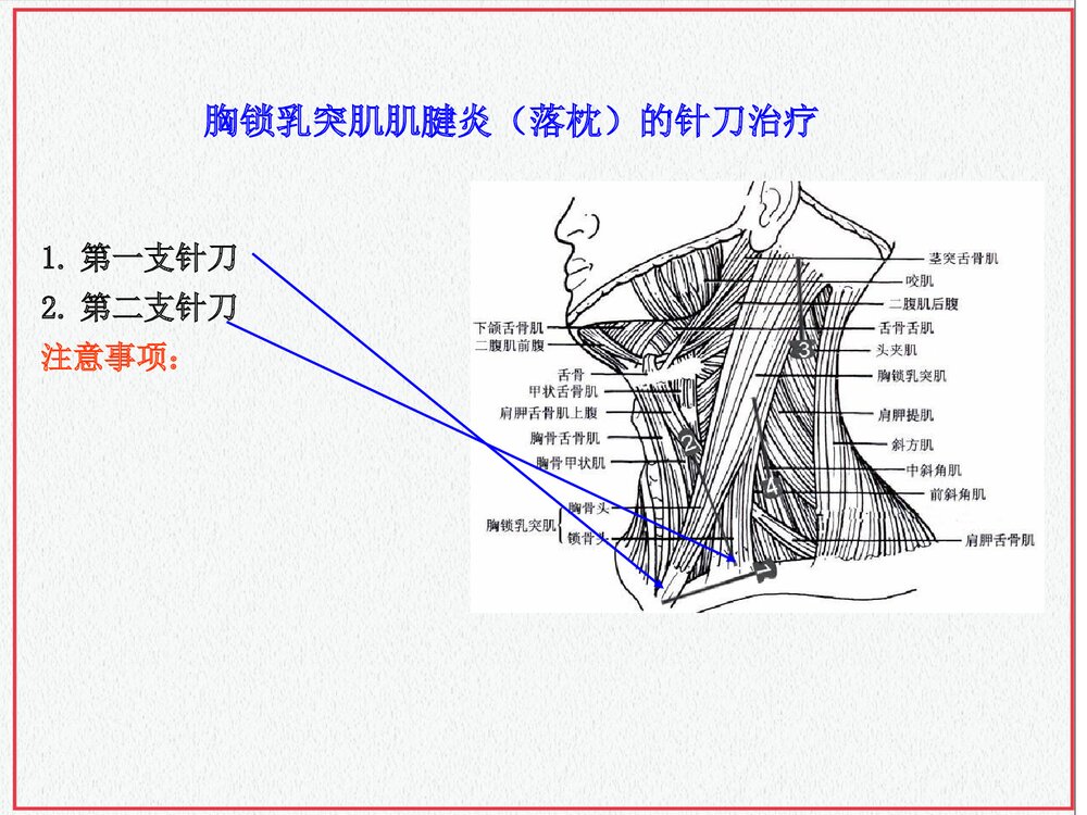 颈部肌肉介绍PPT课件下载(共35页·可编辑修改)9
