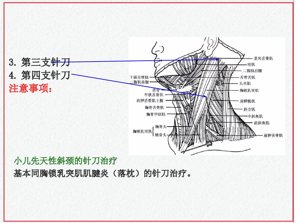颈部肌肉介绍PPT课件下载(共35页·可编辑修改)10