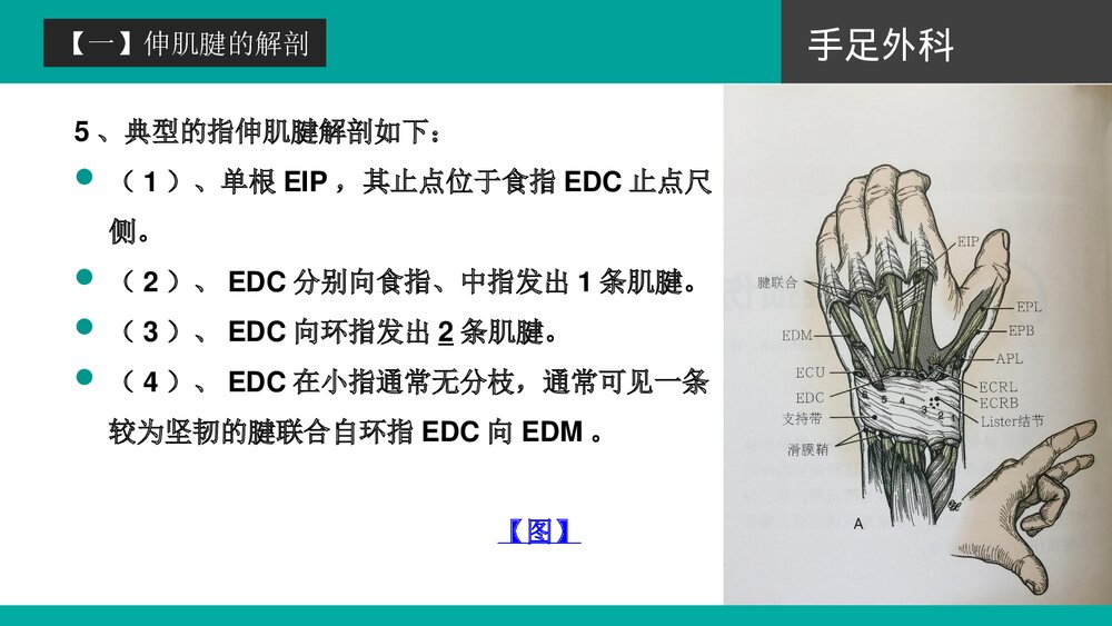 伸肌腱的损伤培训PPT课件下载(共42页·可编辑修改)10