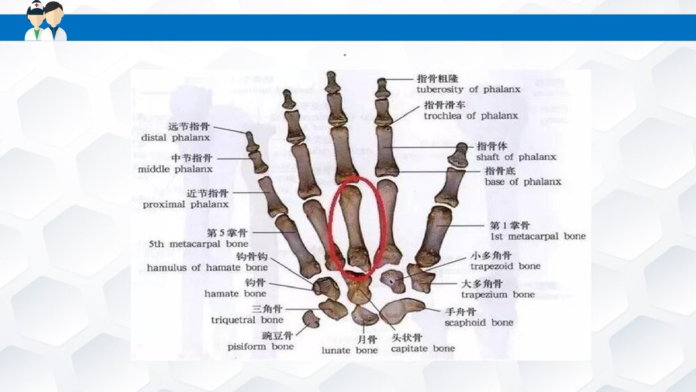 掌骨骨折患者的护理PPT课件下载(共30页·可编辑修改)3