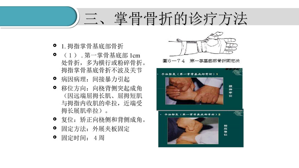 掌骨骨折的护理PPT课件(共23页·可编辑修改)9