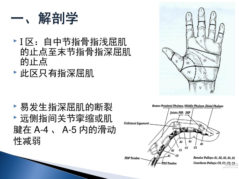 手部屈肌腱损伤康复课件PPT下载(共60页·可编辑修改)10