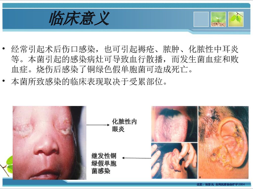 铜绿假单胞菌感染耐药性PPT课件下载7