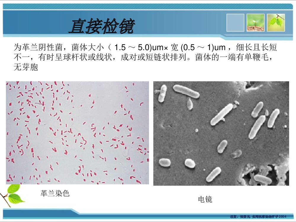 铜绿假单胞菌感染耐药性PPT课件下载9