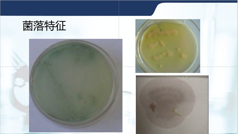 铜绿假单胞菌PPT课件下载4