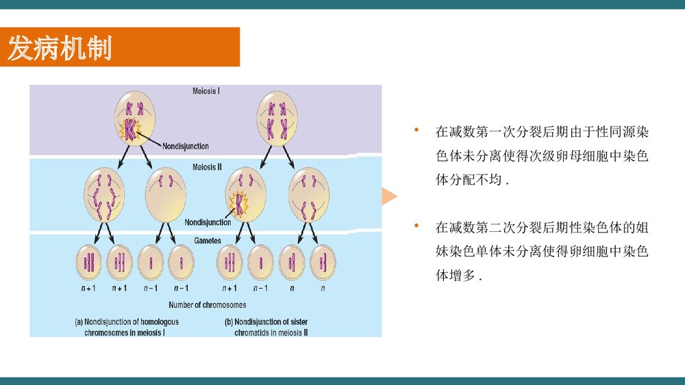X三体综合征PPT课件下载(共21页·可编辑修改)6