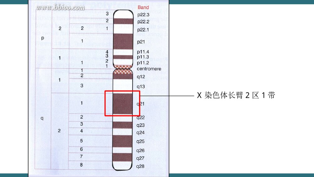 X三体综合征PPT课件下载(共21页·可编辑修改)8