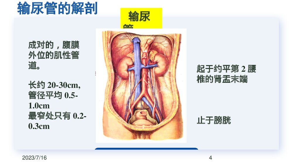 后腹腔镜下输尿管切开取石术PPT课件下载(共23页·可编辑修改)4