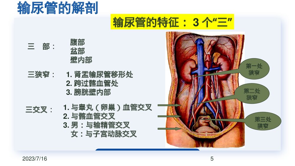 后腹腔镜下输尿管切开取石术PPT课件下载(共23页·可编辑修改)5
