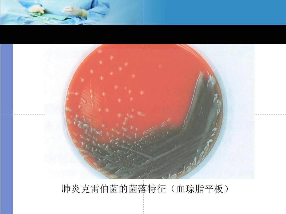 克雷伯菌属PPT课件下载8