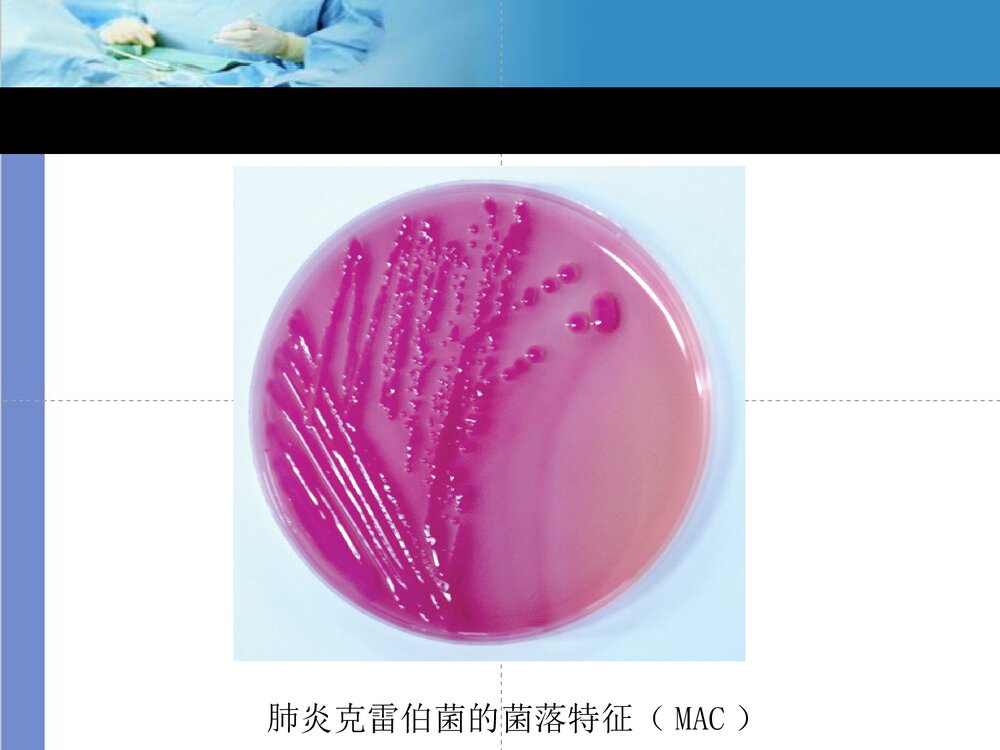 克雷伯菌属PPT课件下载9