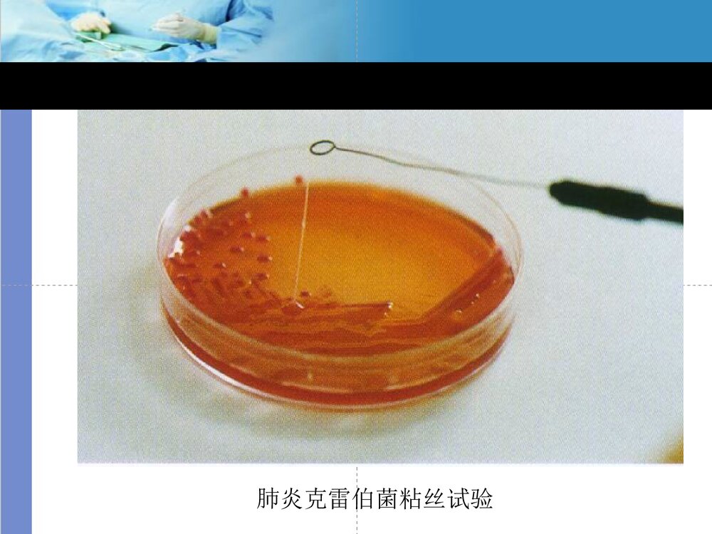 克雷伯菌属PPT课件下载10