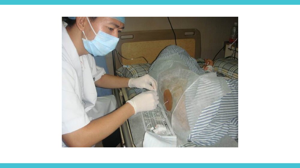 腰大池引流护理PPT课件下载(共22页·可编辑修改)5