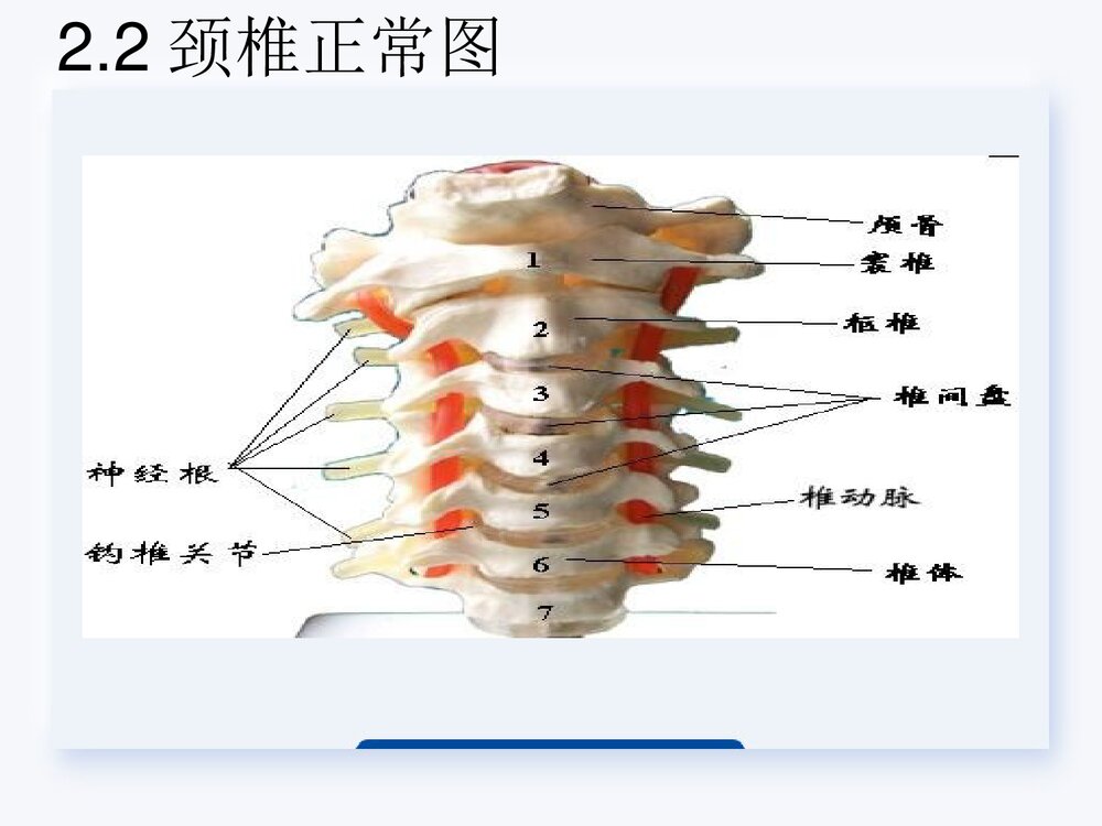 颈椎骨折高位截瘫PPT课件下载6