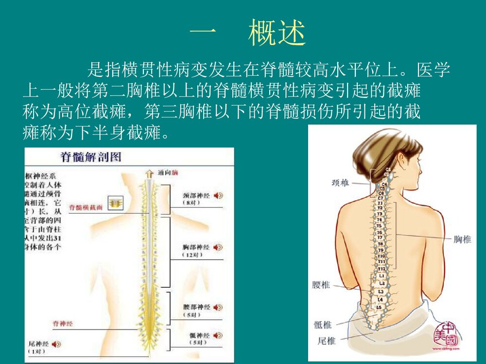 高位截瘫的急救与护理PPT课件下载3