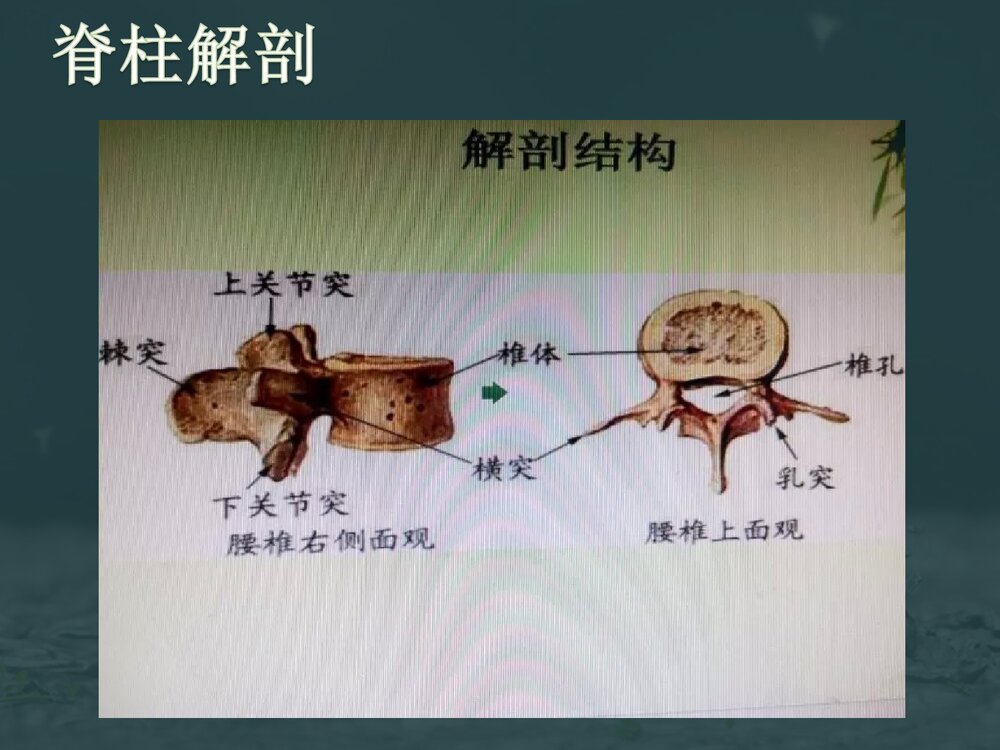 腰椎爆裂性骨折伴截瘫护理查房PPT课件下载5