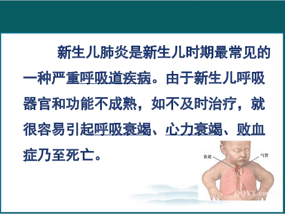 新生儿肺炎的护理PPT课件下载2