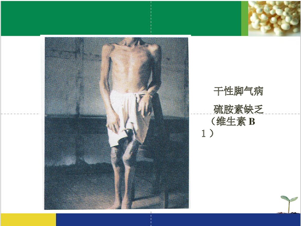 药物化学·维生素PPT课件下载（共76页）7