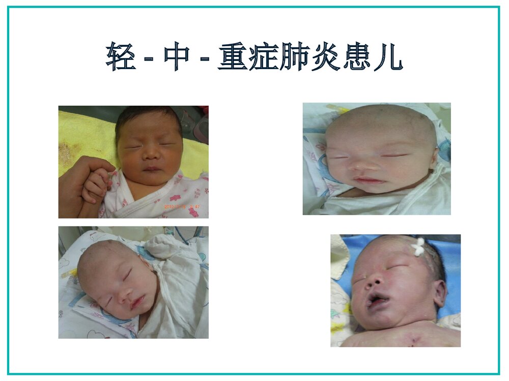 新生儿肺炎及护理PPT课件下载9