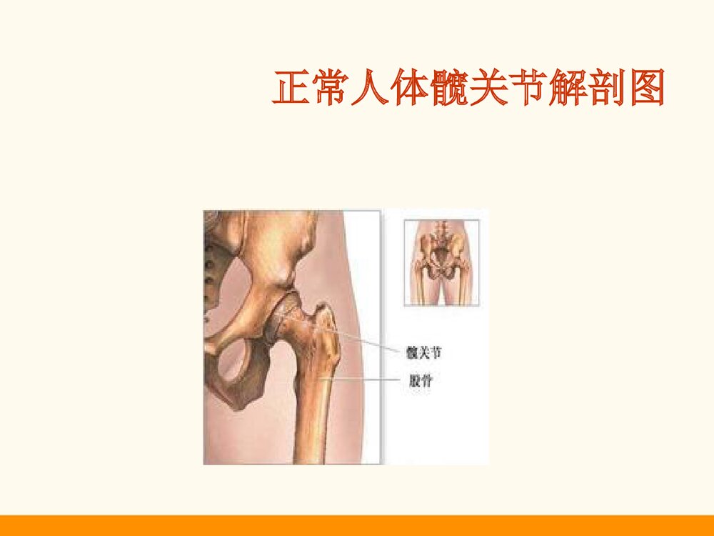 髋关节置换术护理查房PPT课件4