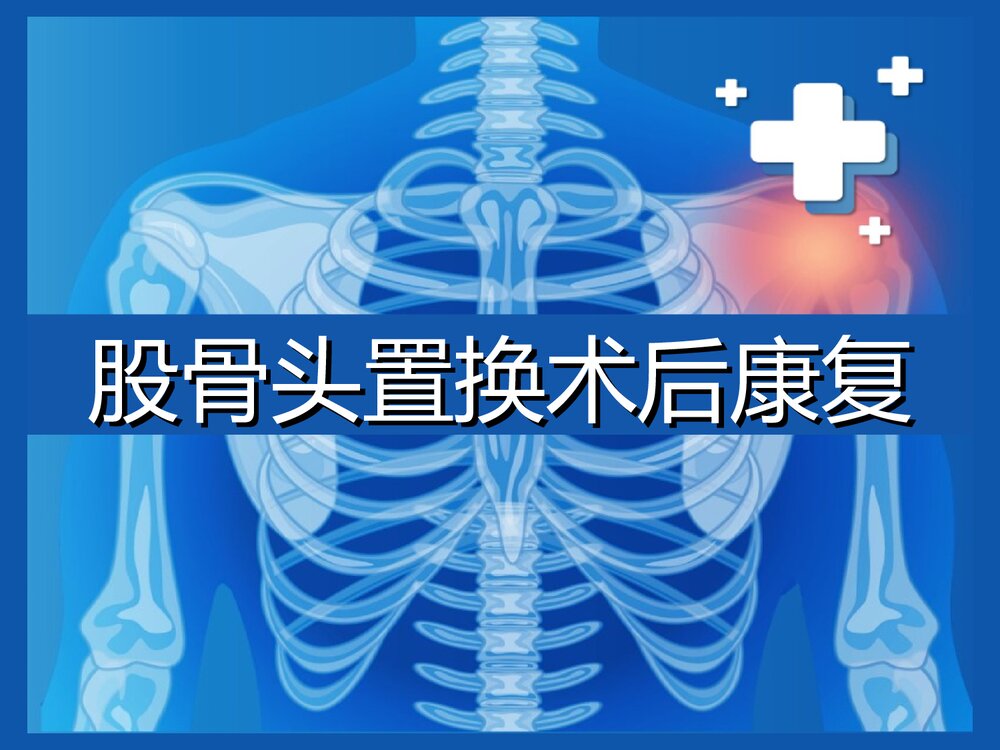 股骨头置换术后康复PPT课件1