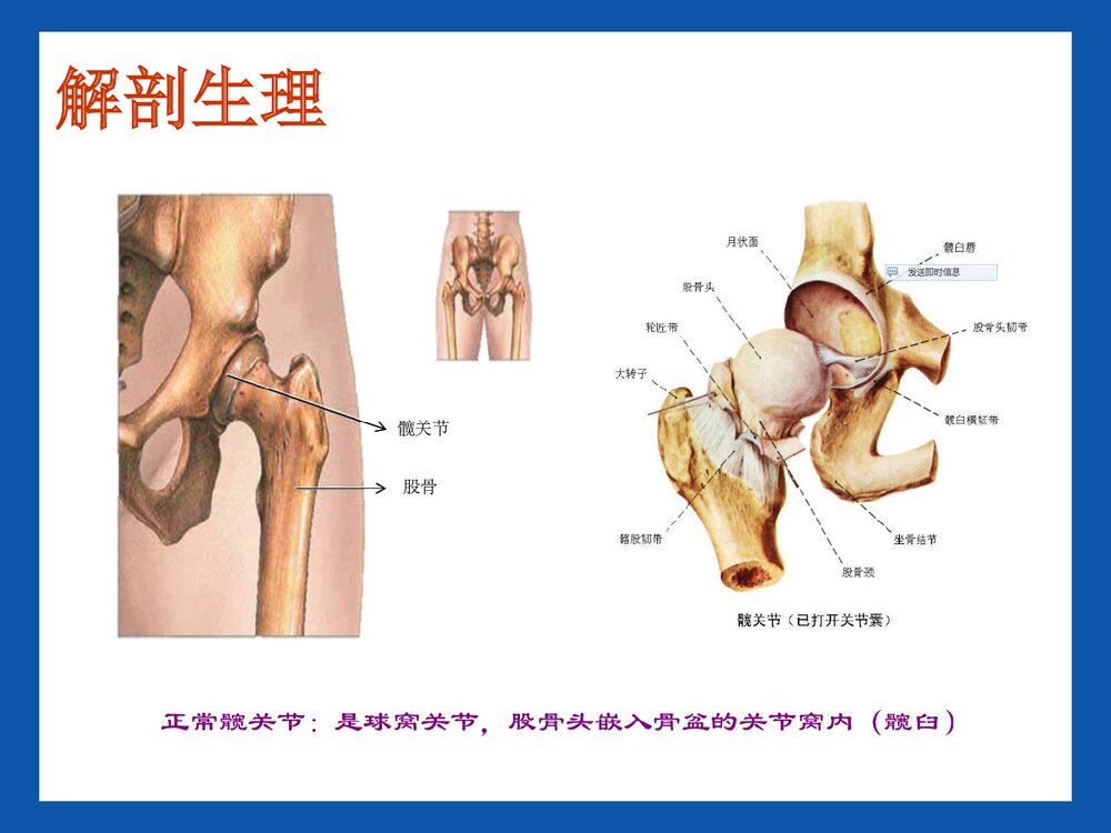 股骨头置换术后康复PPT课件3