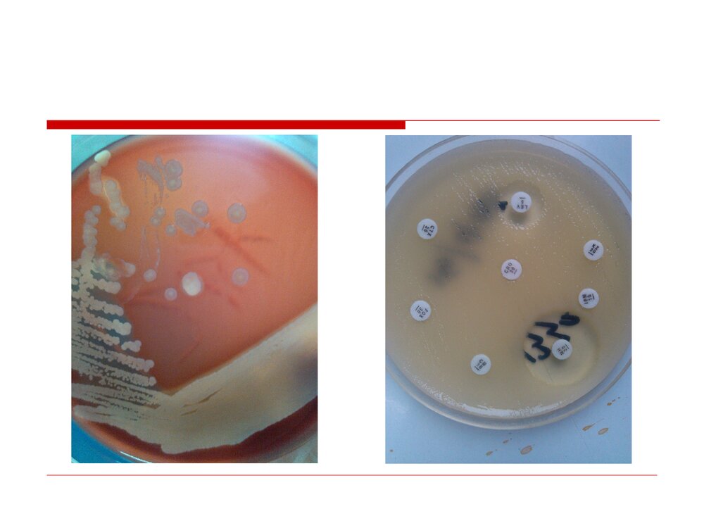 临床微生物标本的采集、运送和处理PPT课件下载4